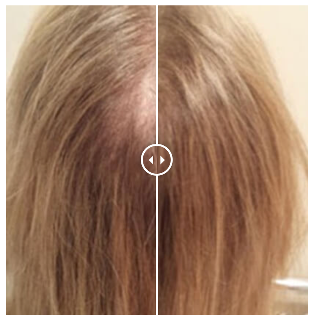 Before-and-after example showing visible changes in part-line coverage